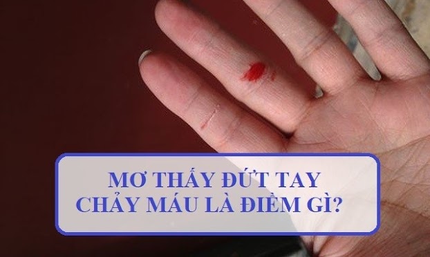 Mơ thấy bị đứt cả bàn